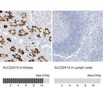 SLC22A13 Antibody in Immunohistochemistry (IHC)