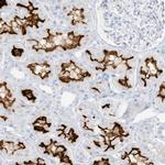 SLC22A13 Antibody in Immunohistochemistry (IHC)