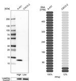 Profilin 2 Antibody in Western Blot (WB)