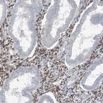 HOXA11 Antibody in Immunohistochemistry (IHC)