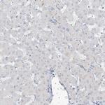 B3GNT7 Antibody in Immunohistochemistry (IHC)