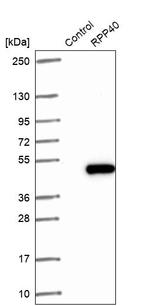 RPP40 Antibody in Western Blot (WB)