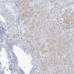 MOXD1 Antibody in Immunohistochemistry (IHC)