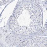 MOXD1 Antibody in Immunohistochemistry (IHC)