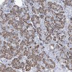 MOXD1 Antibody in Immunohistochemistry (IHC)