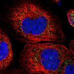 ACOX3 Antibody in Immunocytochemistry (ICC/IF)