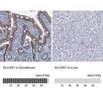 SLC4A7 Antibody in Immunohistochemistry (IHC)