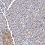 SIDT1 Antibody in Immunohistochemistry (IHC)