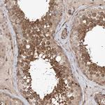 UBTD2 Antibody in Immunohistochemistry (IHC)