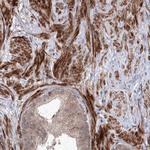 UBTD2 Antibody in Immunohistochemistry (IHC)