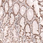 NUP54 Antibody in Immunohistochemistry (IHC)