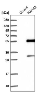 HARS2 Antibody in Western Blot (WB)