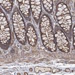 LARS2 Antibody in Immunohistochemistry (IHC)