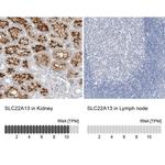 SLC22A13 Antibody