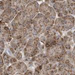 MUT Antibody in Immunohistochemistry (IHC)