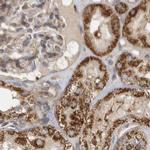 MUT Antibody in Immunohistochemistry (IHC)