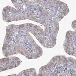 ZC3H6 Antibody in Immunohistochemistry (IHC)