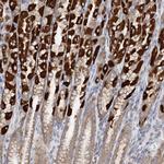 TTC32 Antibody in Immunohistochemistry (IHC)