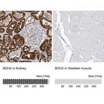 BDH2 Antibody