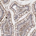 SPPL2A Antibody in Immunohistochemistry (IHC)