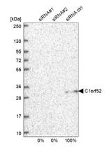 CA052 Antibody in Western Blot (WB)