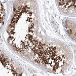 SHCBP1L Antibody in Immunohistochemistry (IHC)