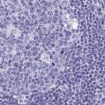 SHCBP1L Antibody in Immunohistochemistry (IHC)