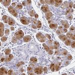 PRR27 Antibody in Immunohistochemistry (IHC)