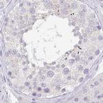 PRR27 Antibody in Immunohistochemistry (IHC)