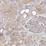 UMPS Antibody in Immunohistochemistry (IHC)