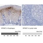 SPINK7 Antibody in Immunohistochemistry (IHC)