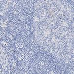 SPINK7 Antibody in Immunohistochemistry (IHC)