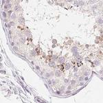 ZBBX Antibody in Immunohistochemistry (IHC)