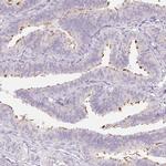 ZBBX Antibody in Immunohistochemistry (IHC)