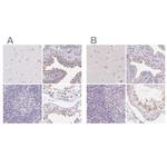 ZBBX Antibody in Immunohistochemistry (IHC)