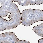 ADGB Antibody in Immunohistochemistry (IHC)