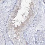 ADGB Antibody in Immunohistochemistry (IHC)