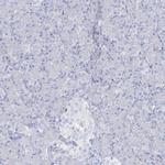 ADGB Antibody in Immunohistochemistry (IHC)