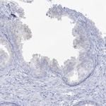 ADGB Antibody in Immunohistochemistry (IHC)