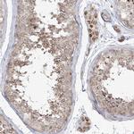 LACTB Antibody in Immunohistochemistry (IHC)