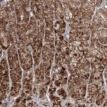 LACTB Antibody in Immunohistochemistry (IHC)