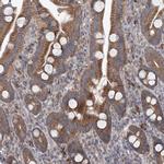 RF1ML Antibody in Immunohistochemistry (IHC)