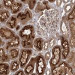 OBSL1 Antibody in Immunohistochemistry (IHC)