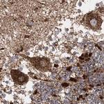 LRP130 Antibody in Immunohistochemistry (IHC)