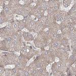 LRP130 Antibody in Immunohistochemistry (IHC)