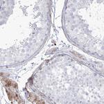 HYAL2 Antibody in Immunohistochemistry (IHC)