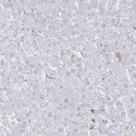 HYAL2 Antibody in Immunohistochemistry (IHC)