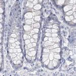 DMGDH Antibody in Immunohistochemistry (IHC)