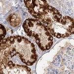 DMGDH Antibody in Immunohistochemistry (IHC)