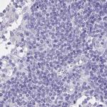 DMGDH Antibody in Immunohistochemistry (IHC)